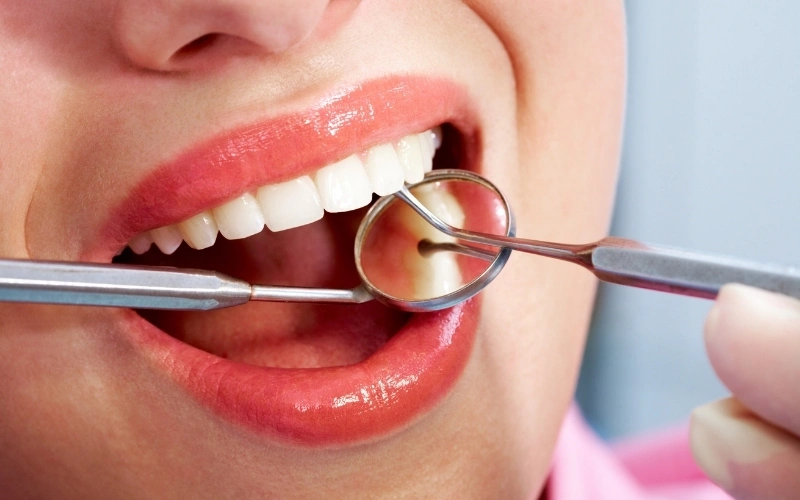 Routine dental check-up and oral examination Dentist examining teeth during a routine dental check-up at Smile Studio Dental, Markham