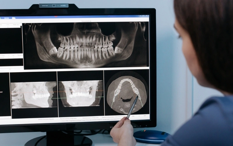 ezgif-8e7c53a4d848dc family friendly dental clinic in cambridge